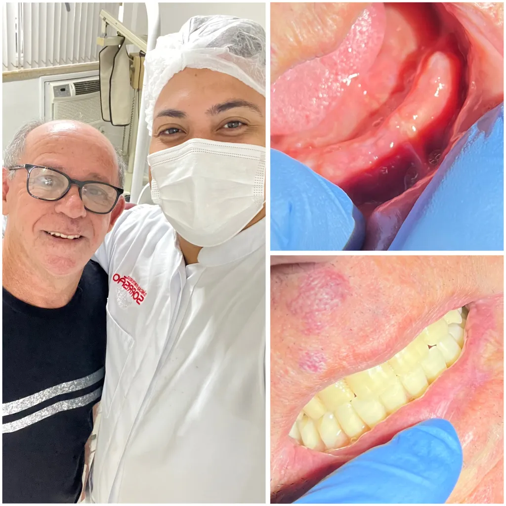 Cirurgião dentista avaliando tomografia para enxerto ósseo